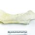 Pelvis 1986.008.0818